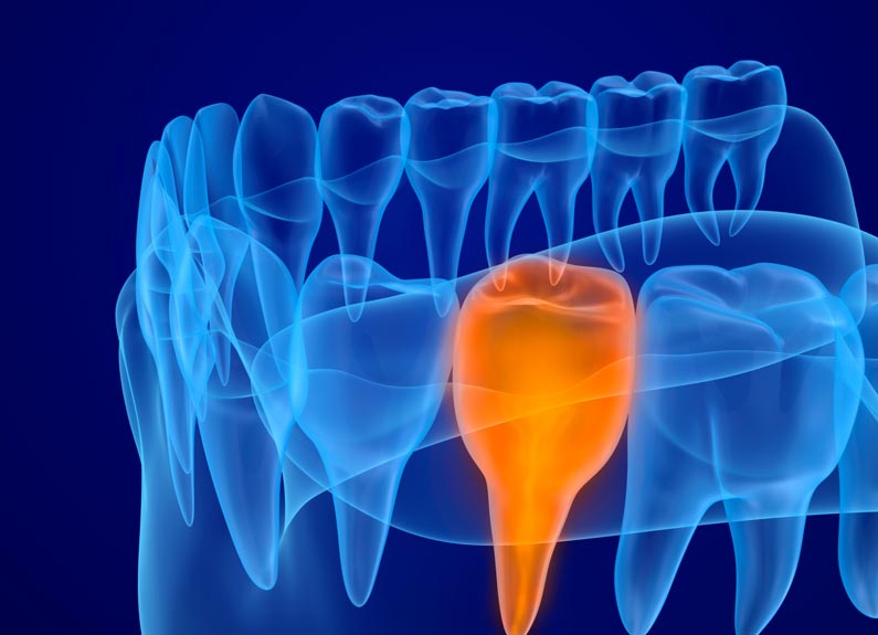 el diagnóstico en tratamientos de ortodoncia y su importancia