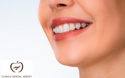 ¿Es mejor la ortodoncia invisible o los brackets transparentes?